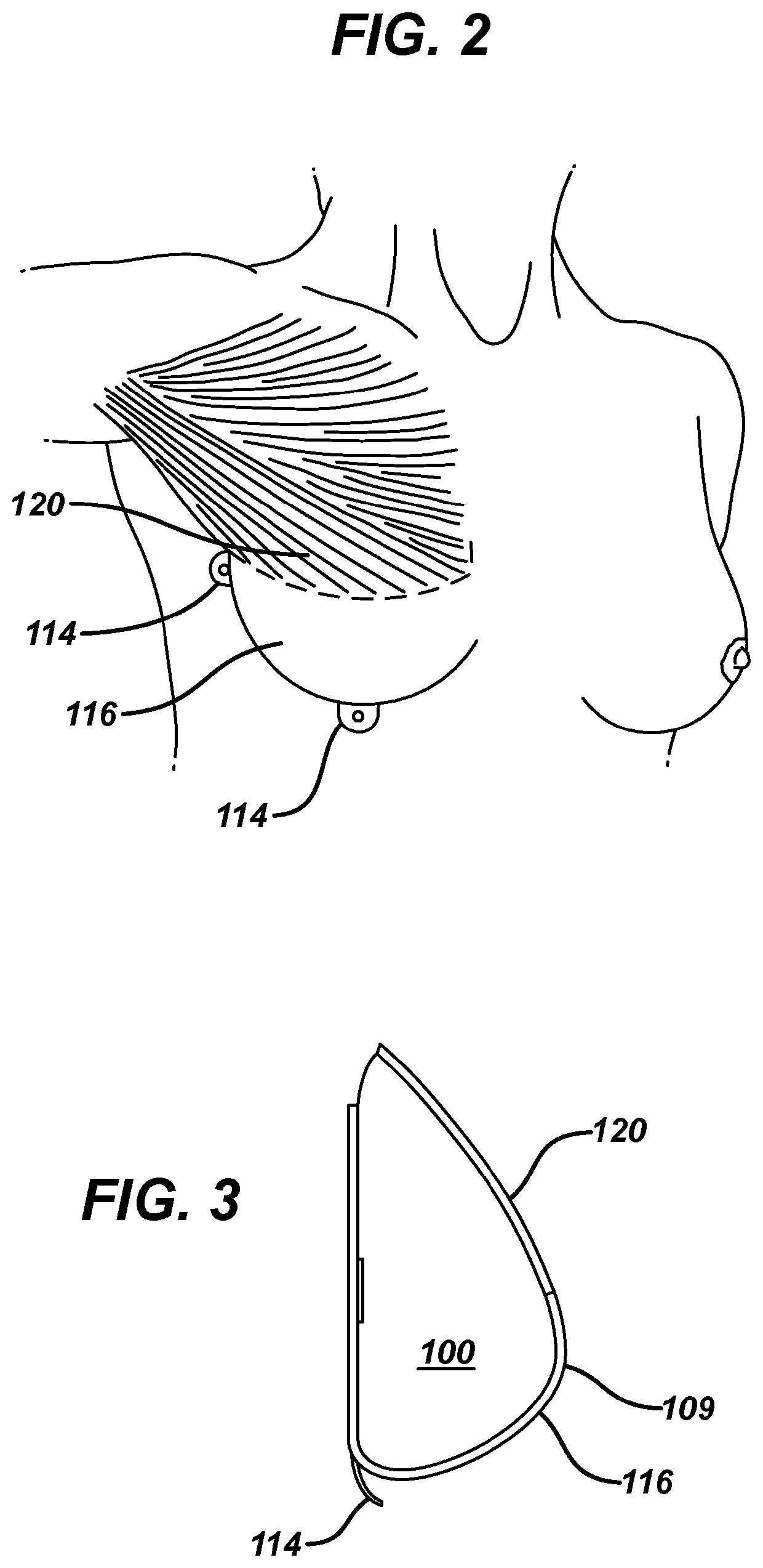 Tissue expander with pectoral attachment