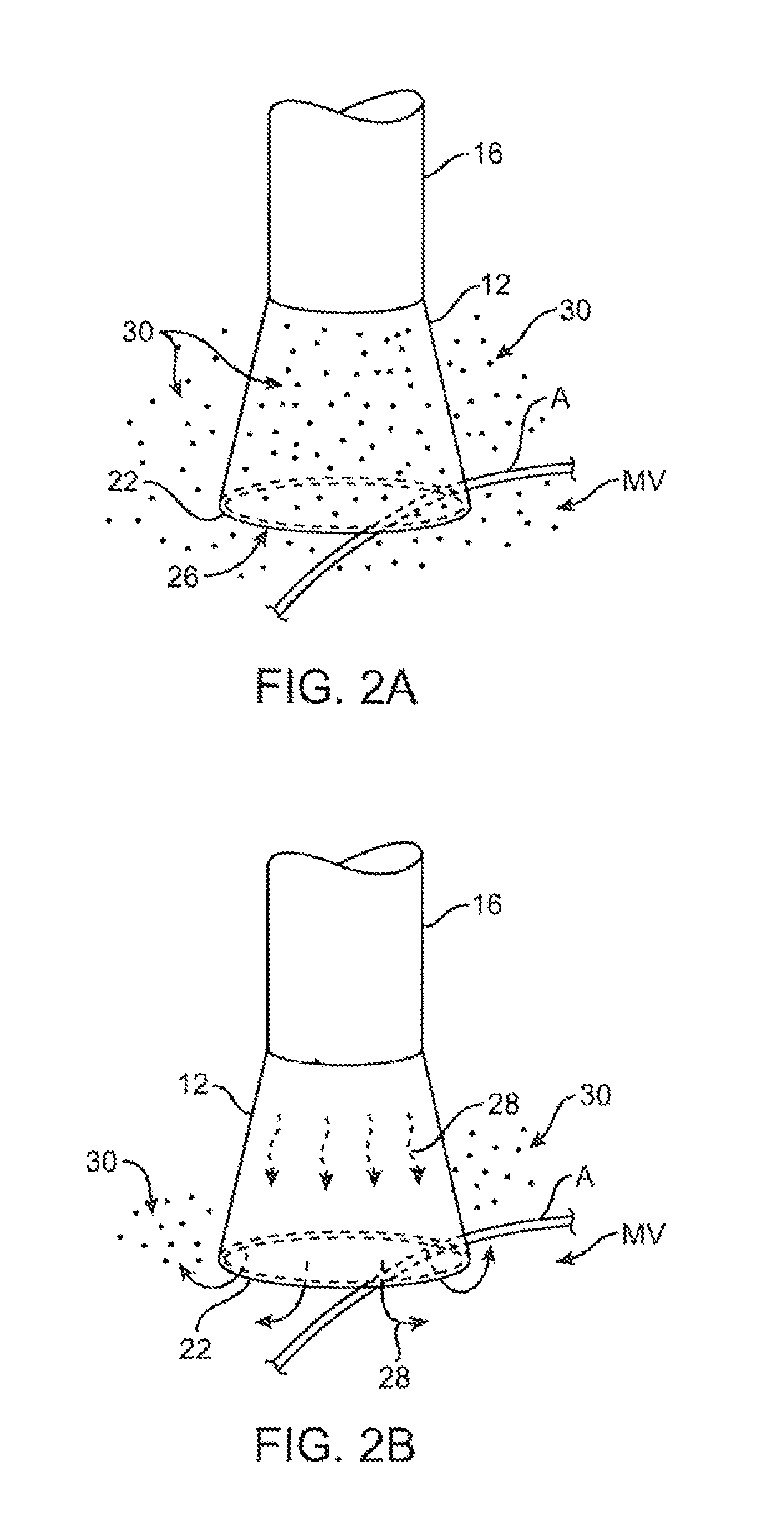Method of forming electrode placement and connection systems