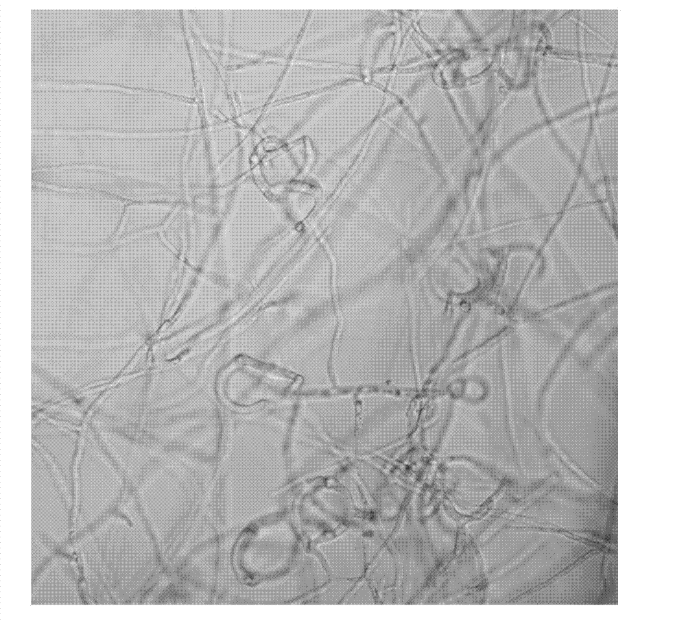 Application of stenotrophomonas rhizophila and cyclic dipeptide metabolite thereof