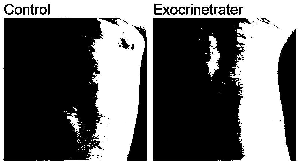 Preparation method and application of artificial exosome complex