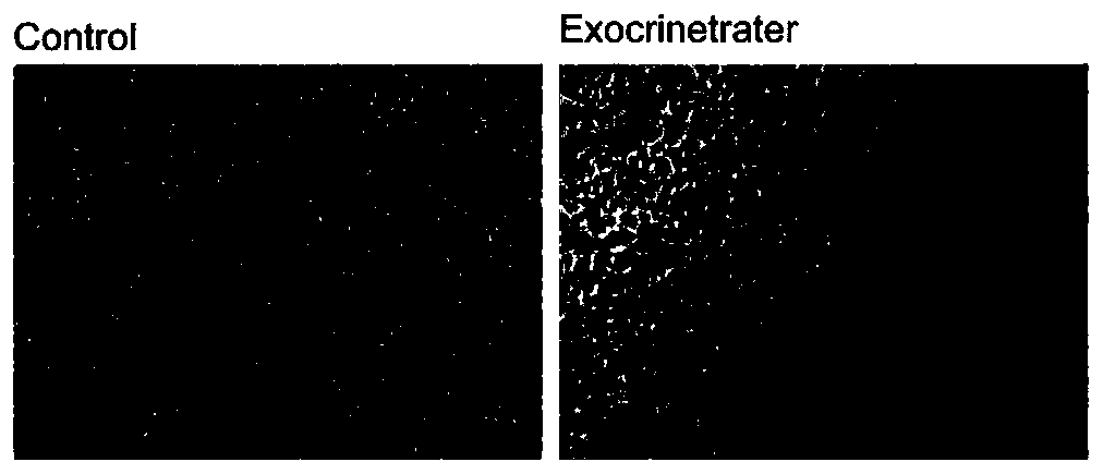 Preparation method and application of artificial exosome complex