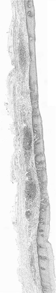 A Segmentation Method of Epithelial Tissue in Esophagus Pathological Image