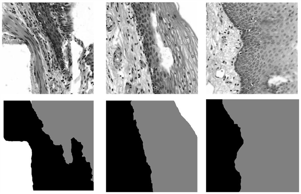 A Segmentation Method of Epithelial Tissue in Esophagus Pathological Image