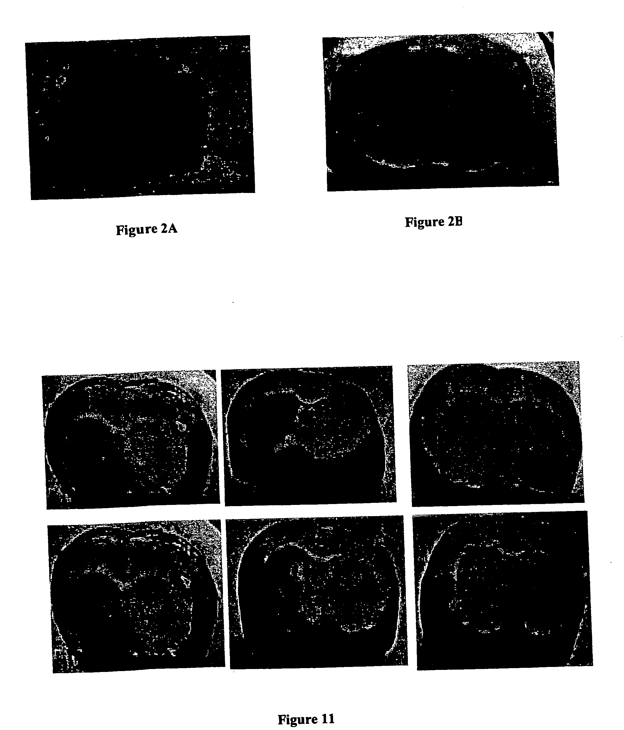 Method for using potassium channel activation for delivering a medicant to an abnormal brain region and/or a malignant tumor
