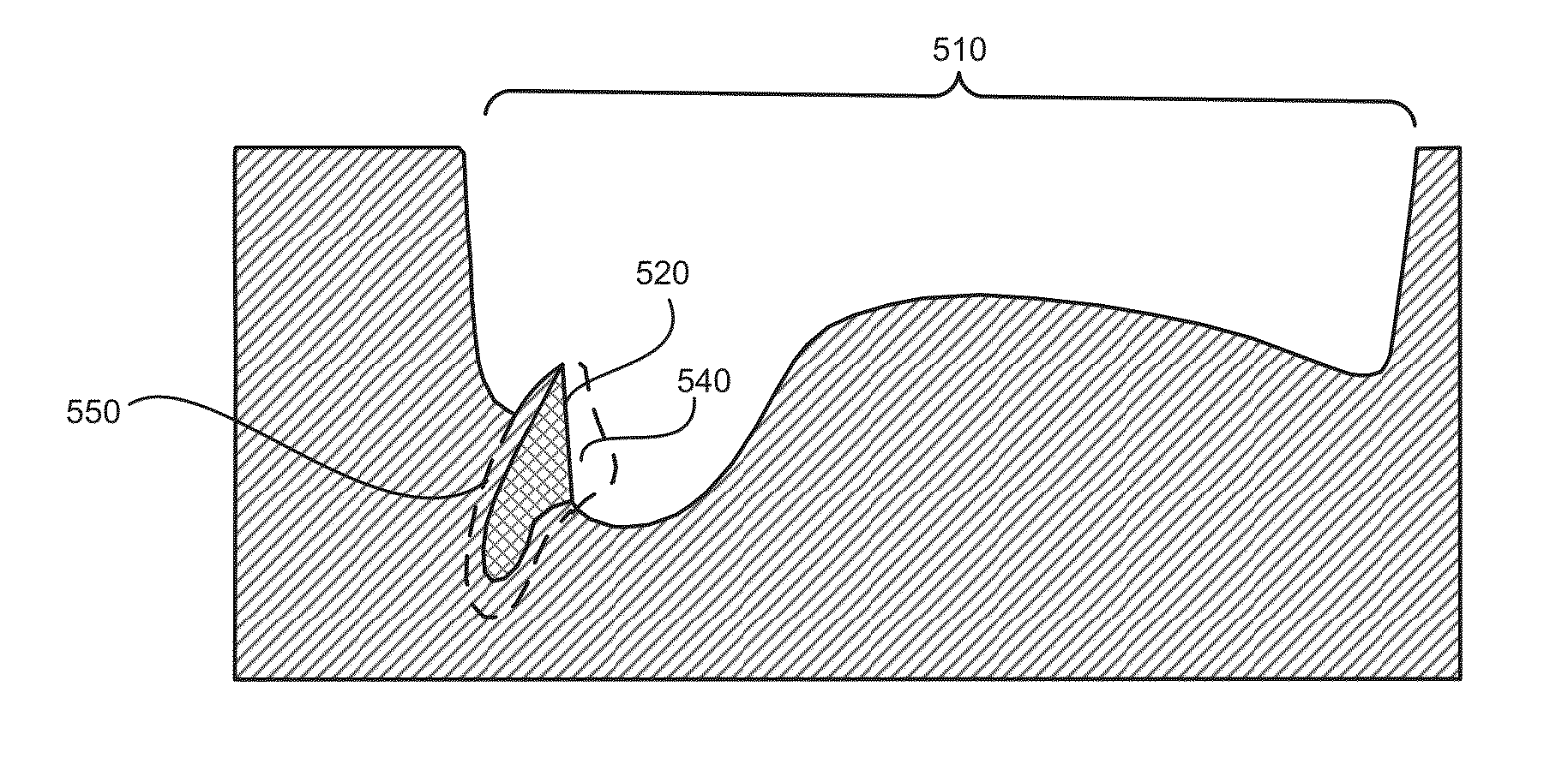 System and method for manufacturing layered dentures