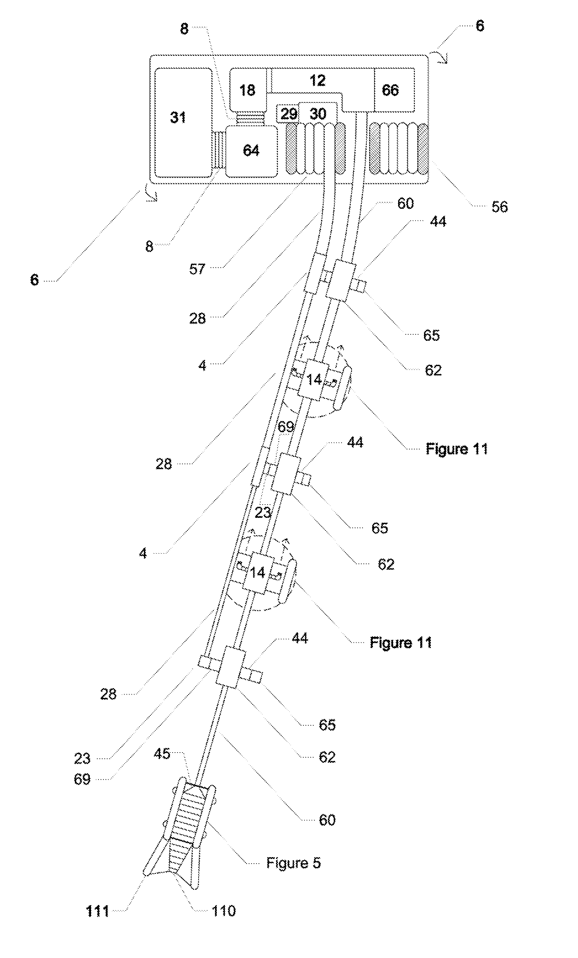 Apparatus for Vacuuming Pollution from a Body of Water