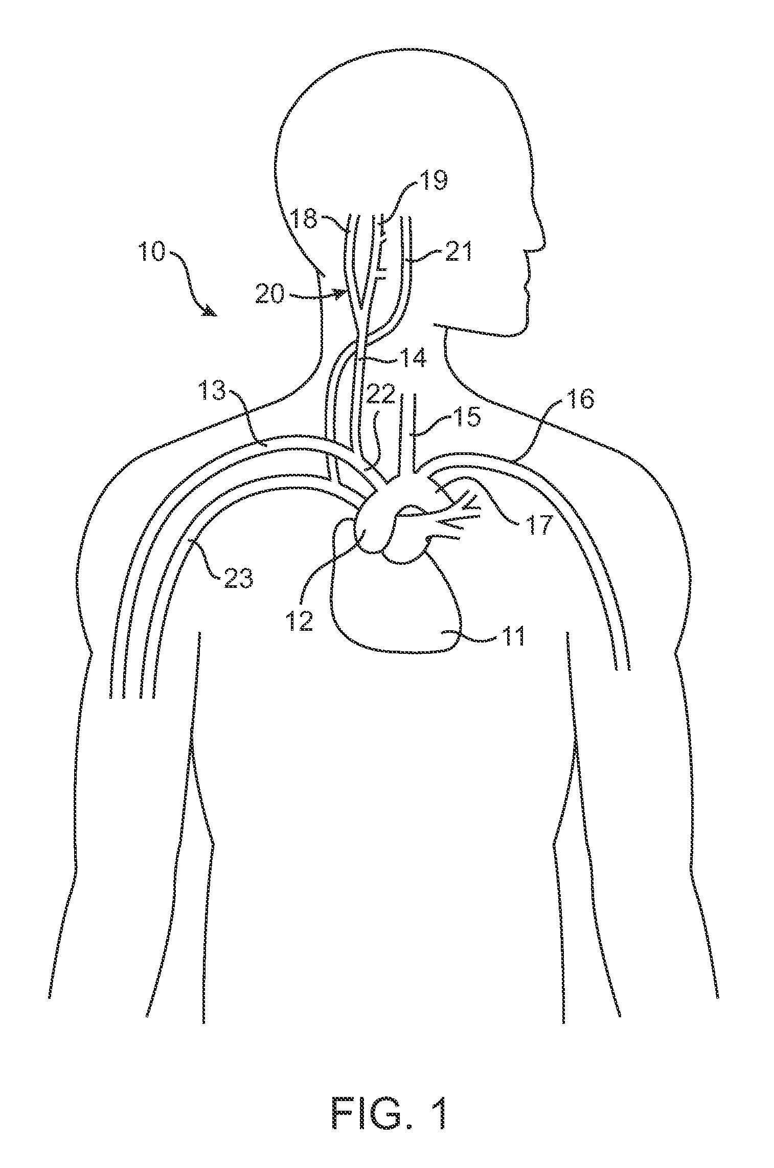 Electrode array structures and methods of use for cardiovascular reflex control