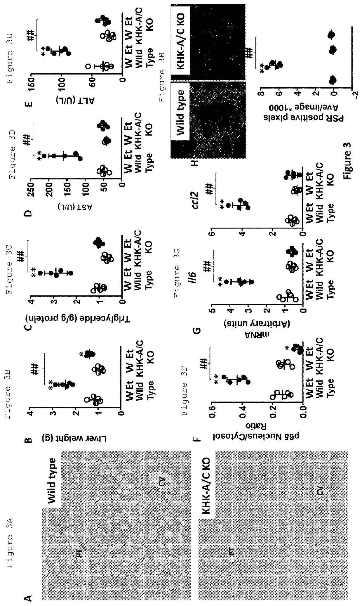 Methods for fructokinase mediation of alcohol craving and alcohol induced liver disease