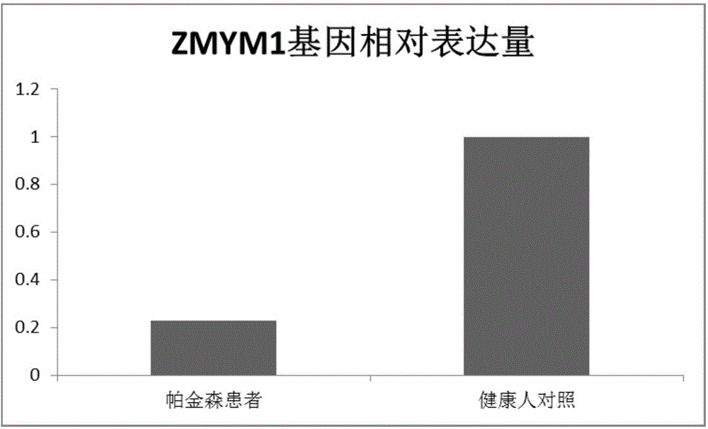 Application of ZMYM1 in preparation of Parkinson's disease diagnosis and treatment reagents