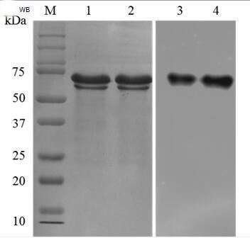 A hybridoma cell line secreting anti-chromaffin-a monoclonal antibody and its application