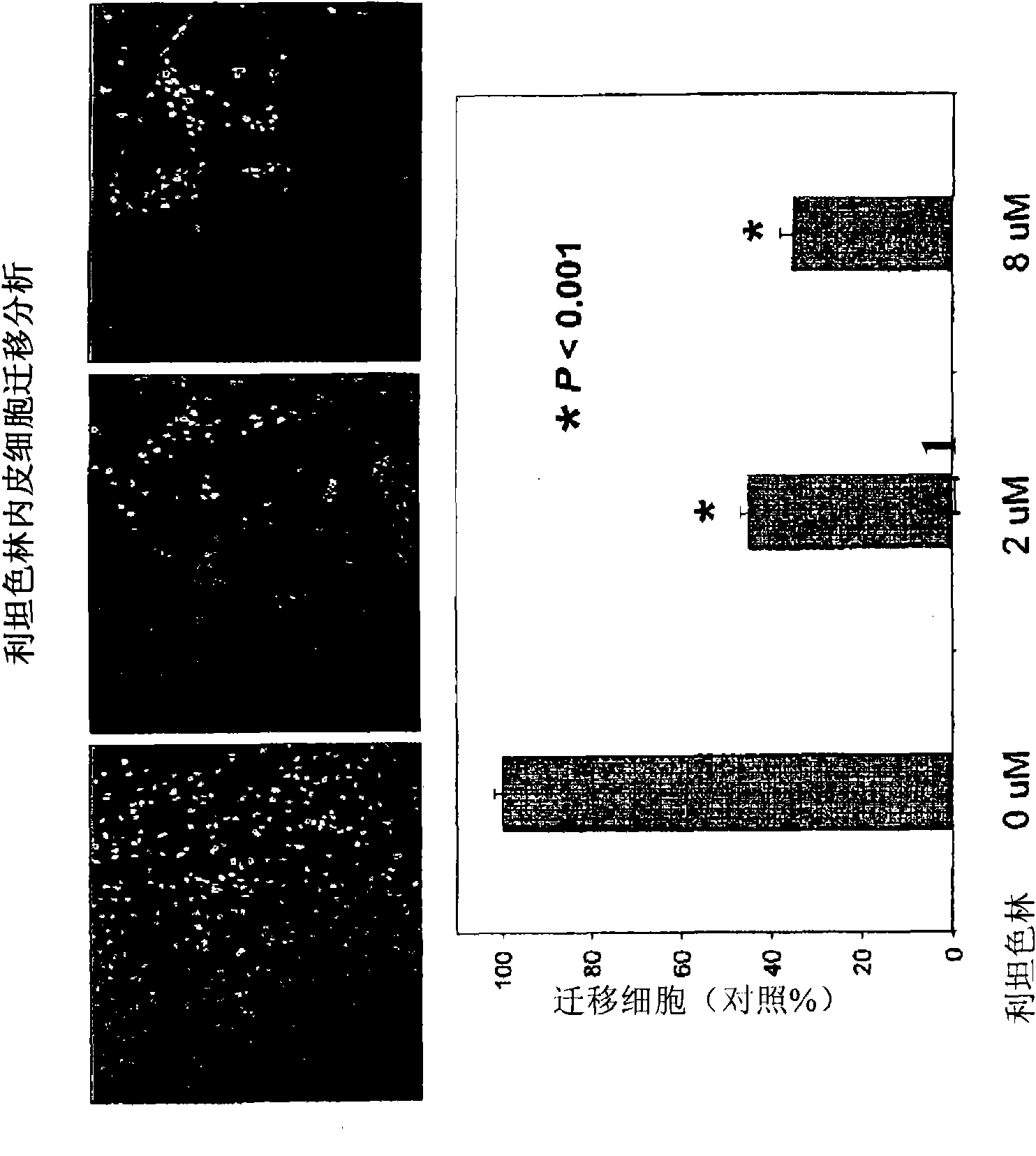 Anti-angiogenic agents and methods of use