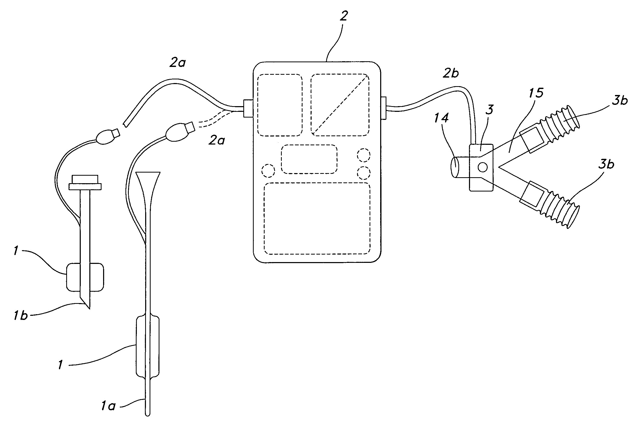 Method of triggering a ventilator