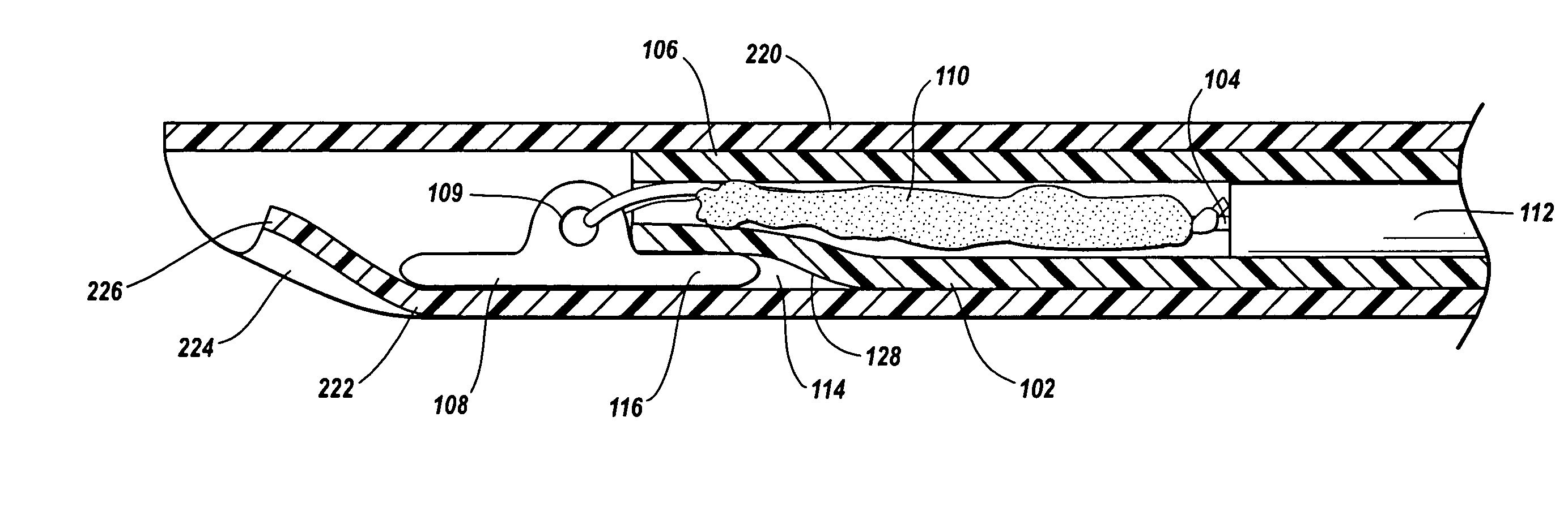 Vascular insertion sheath with stiffened tip