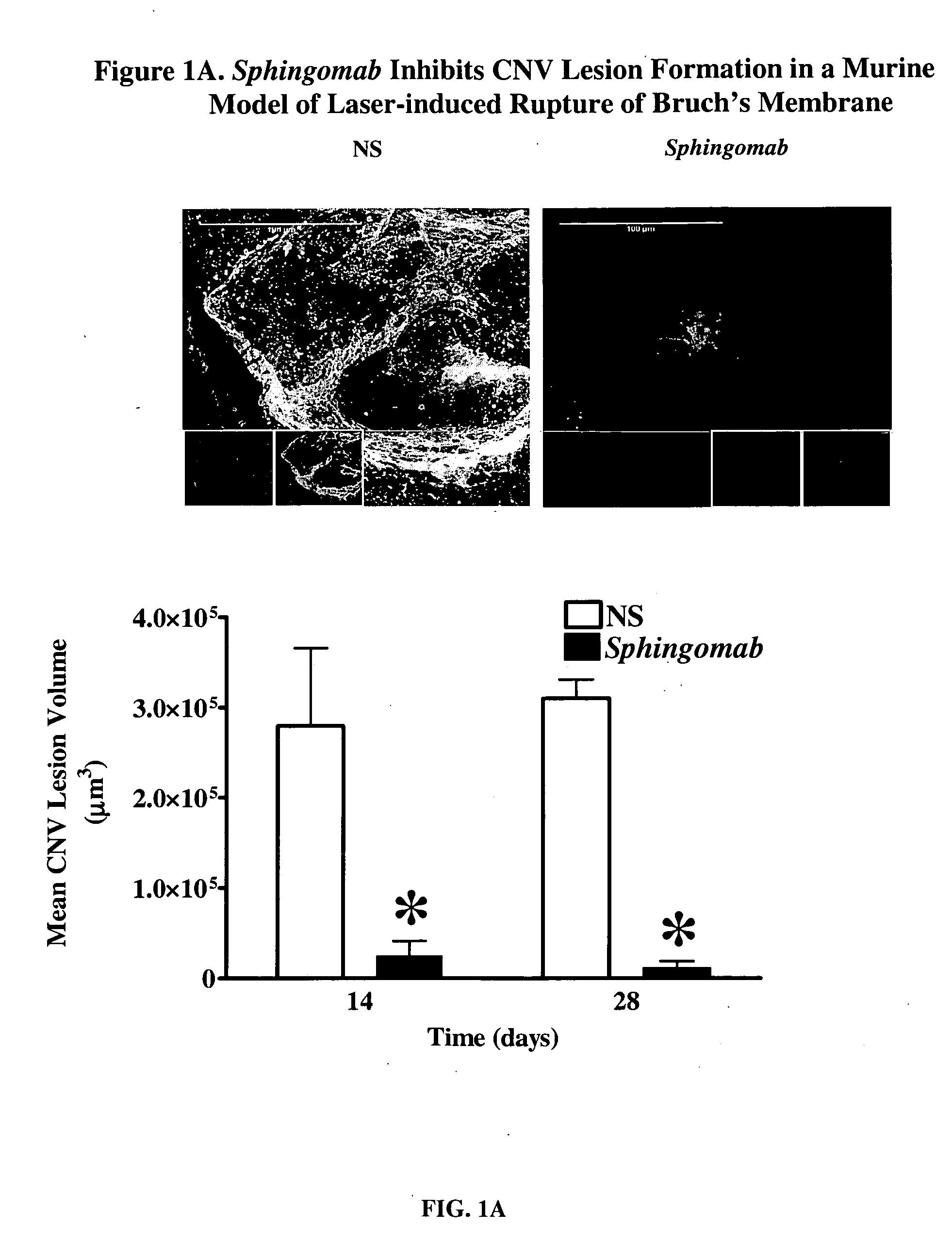 Compositions and methods for the treatment and prevention of fibrotic, inflammatory and neovascularization conditions