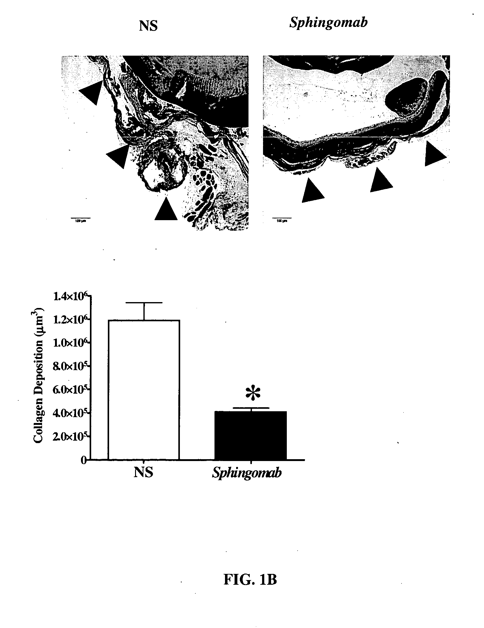 Compositions and methods for the treatment and prevention of fibrotic, inflammatory and neovascularization conditions