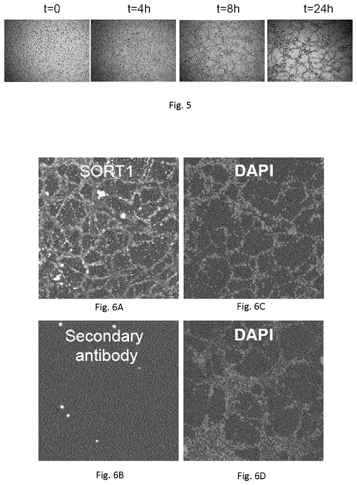 Methods and compounds for targeting sortilin receptors and inhibiting vasculogenic mimicry