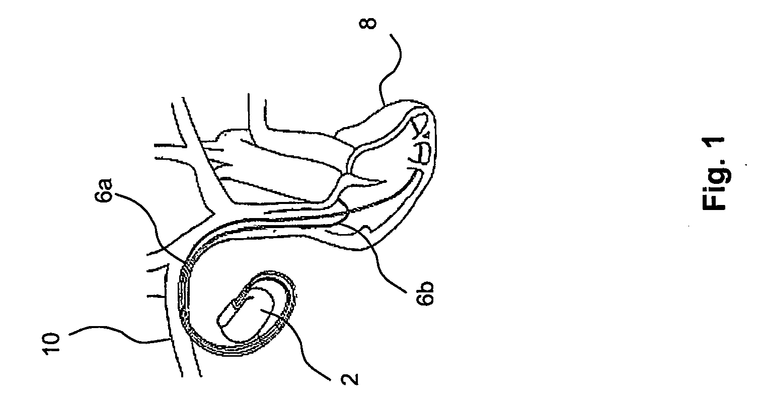 Medical device for determining the posture of patient