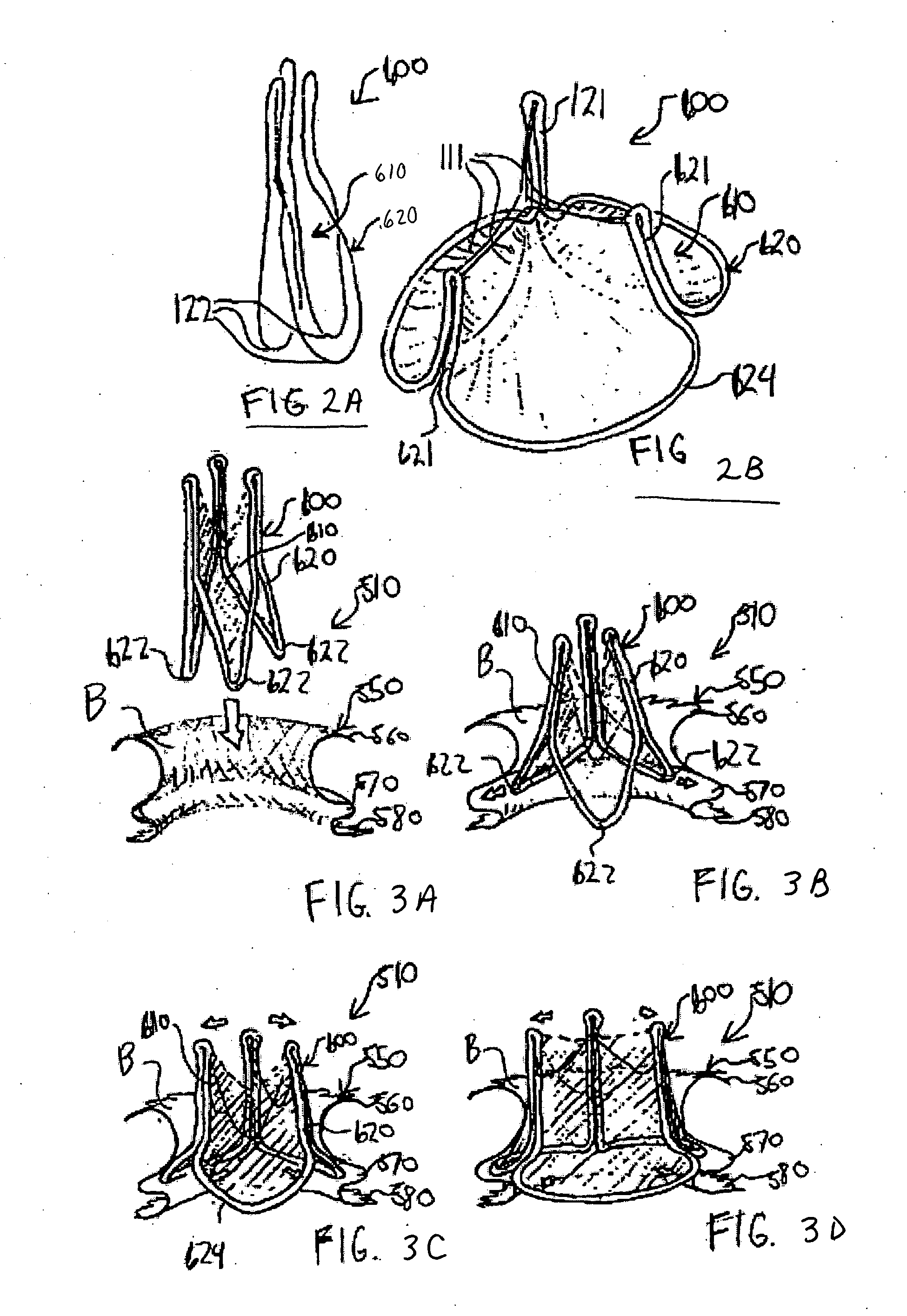 Two piece heart valve and anchor