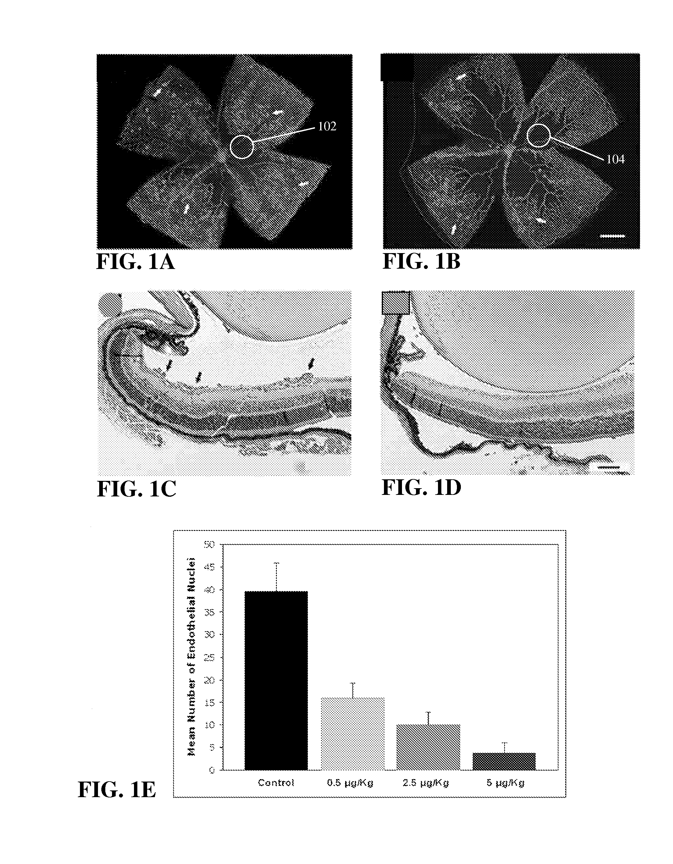 Methods and compositions for treating diseases associated with neovascualrization