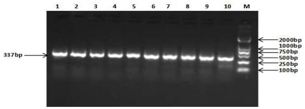 A Molecular Marker Related to Sheep Feed Conversion Rate and Its Application