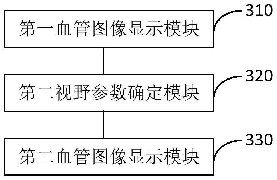 Image display method and device, angiography device and storage medium