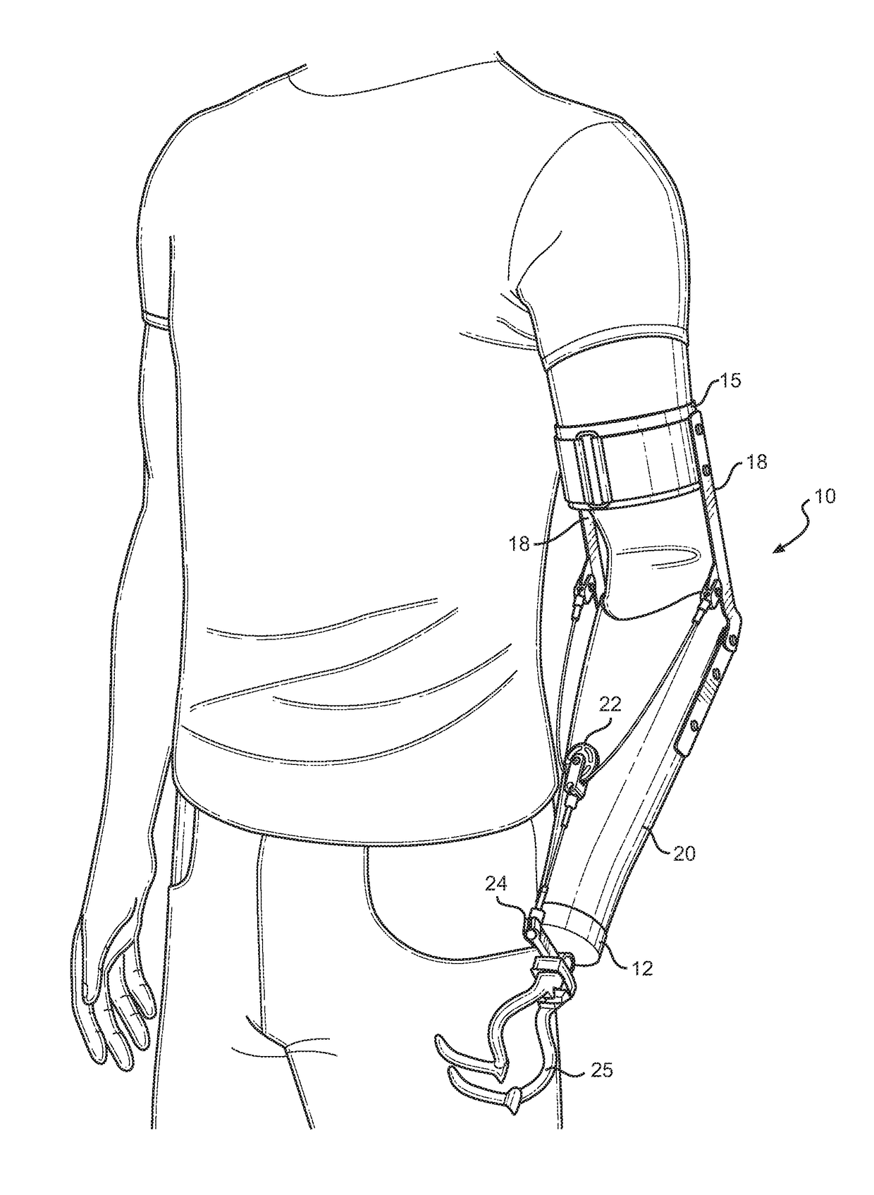 Harness for Upper Extremity Below-Elbow Prosthesis