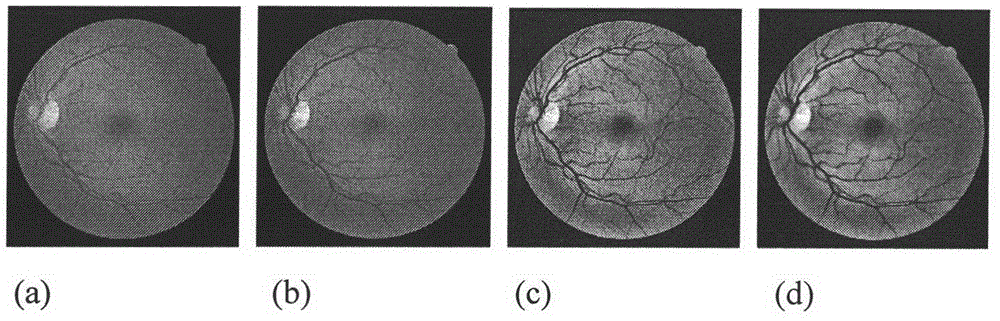 Eyeground image blood vessel segmentation method based on self-adaption difference of Gaussians