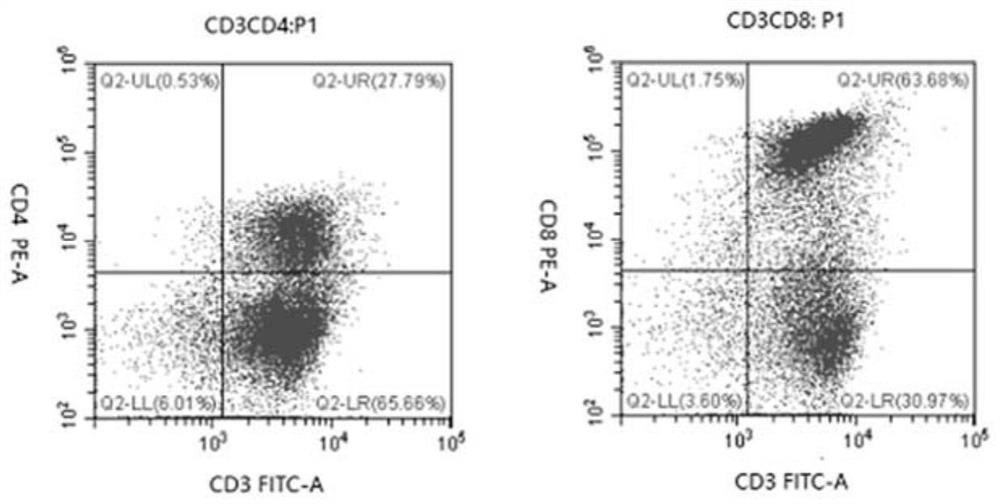 Dendritic cell vaccine sensitized by A2B5 + glioma cells
