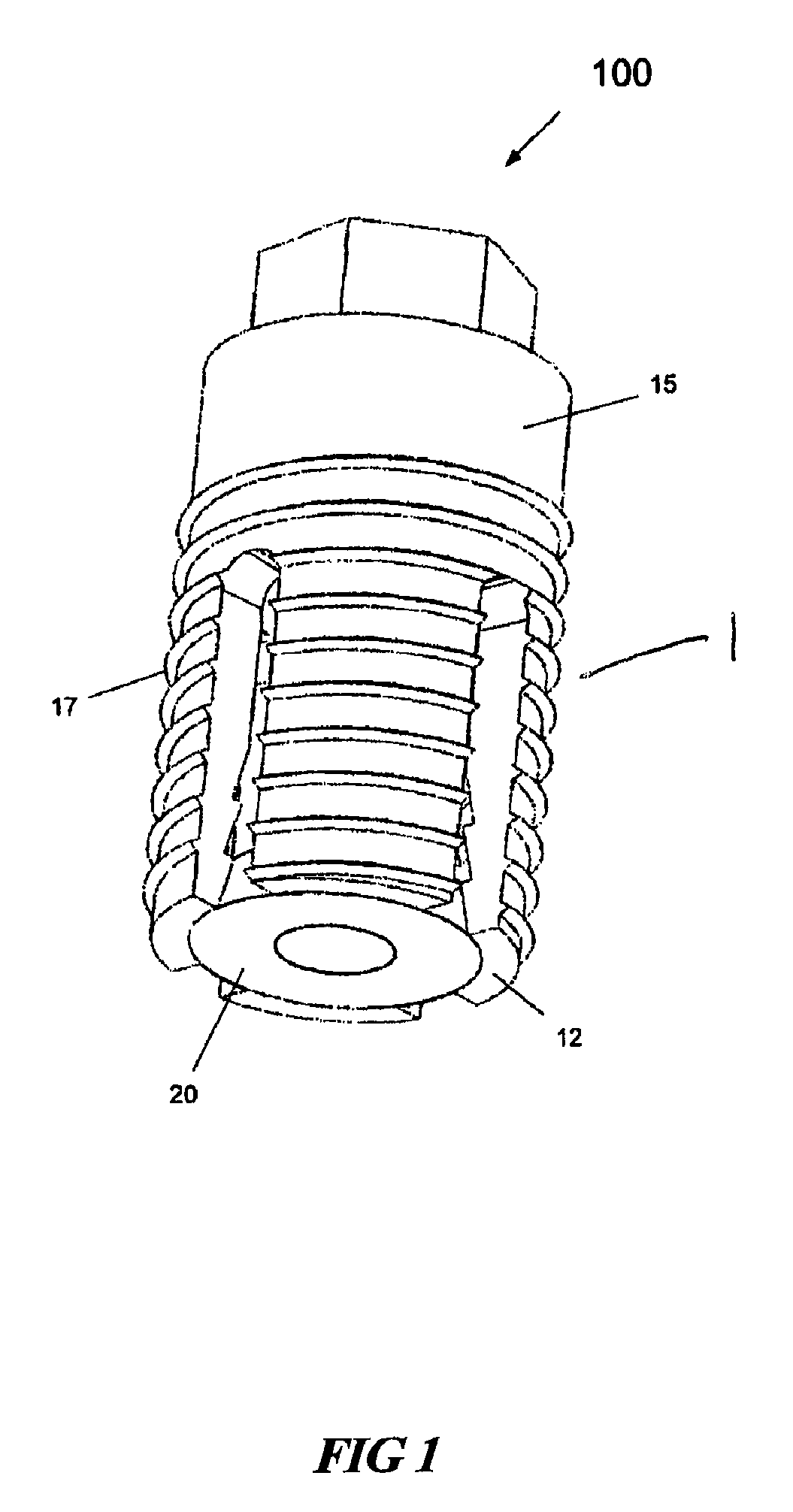 Expandable dental implants of high surface area and methods of expanding the same
