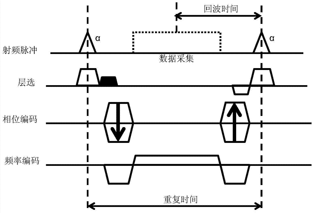 Black blood control method and system in time-reversal steady-state precession fast imaging sequence