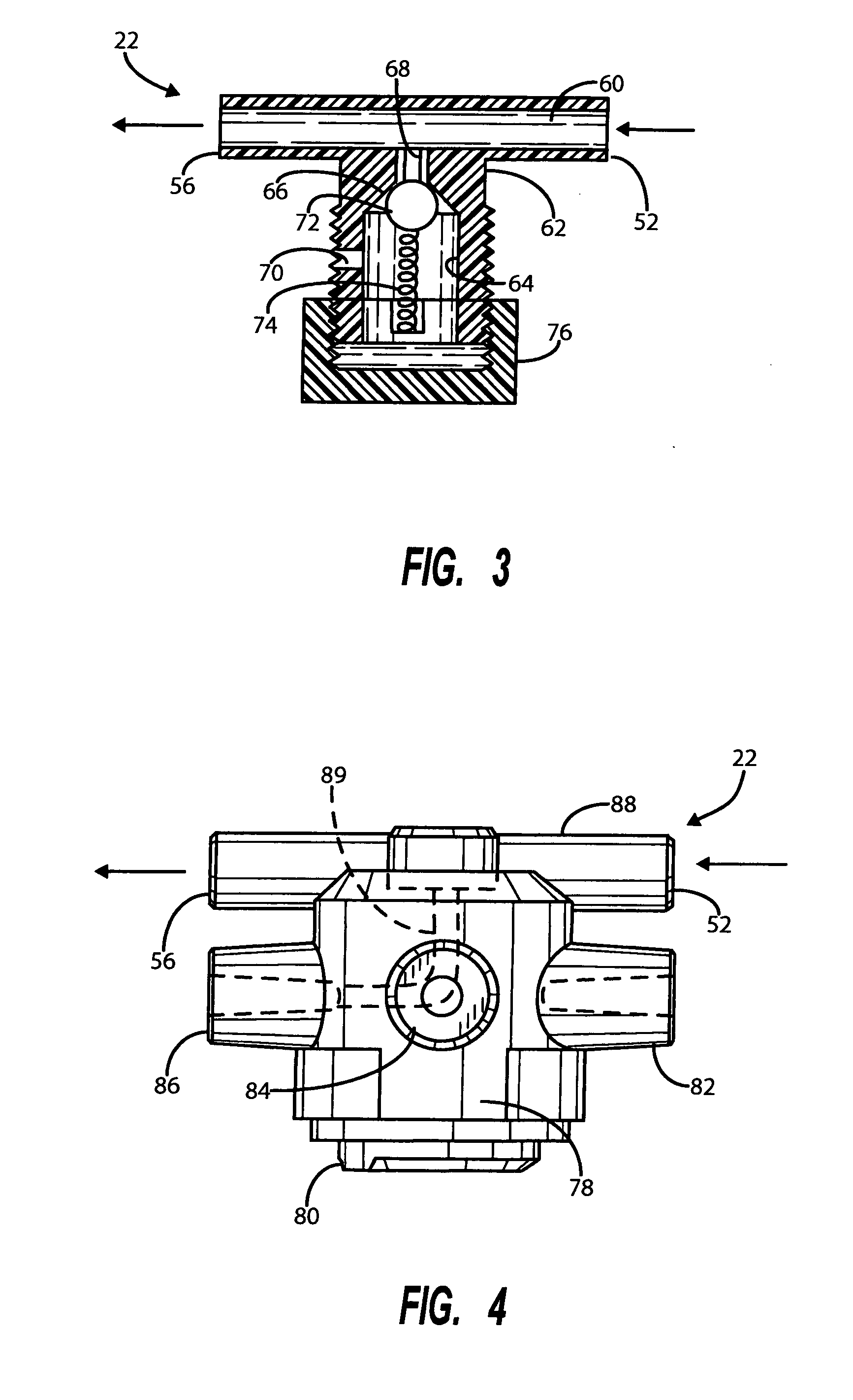 Middle ear pressure equalizing device with improved pressure control