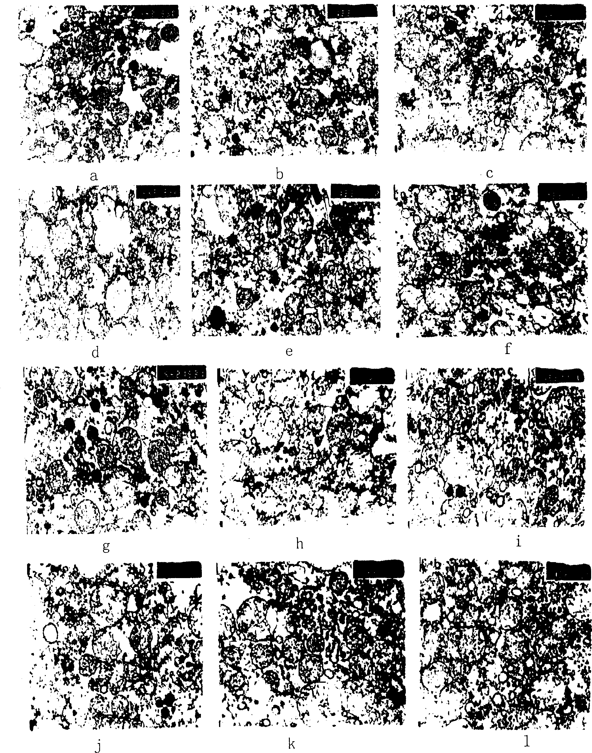 Ripening agent and eliminating agent for abnormal black balliary matter and its preparation method