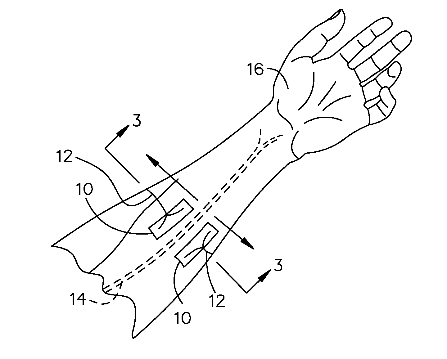 Phlebotomy aid device