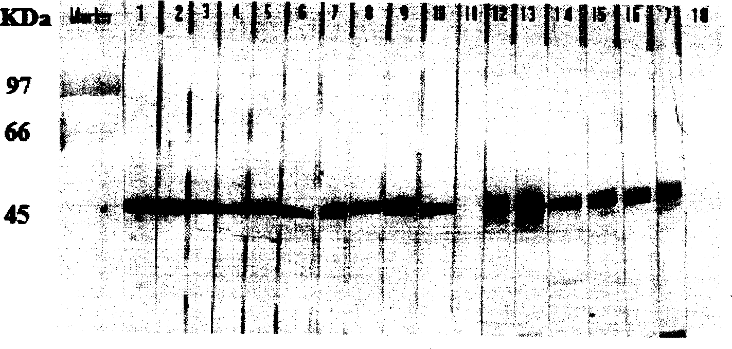 SARS coronavirus nucleocapsid protein monoclonal antibody, hybridoma for producing the same, detection agent containing the same and use thereof