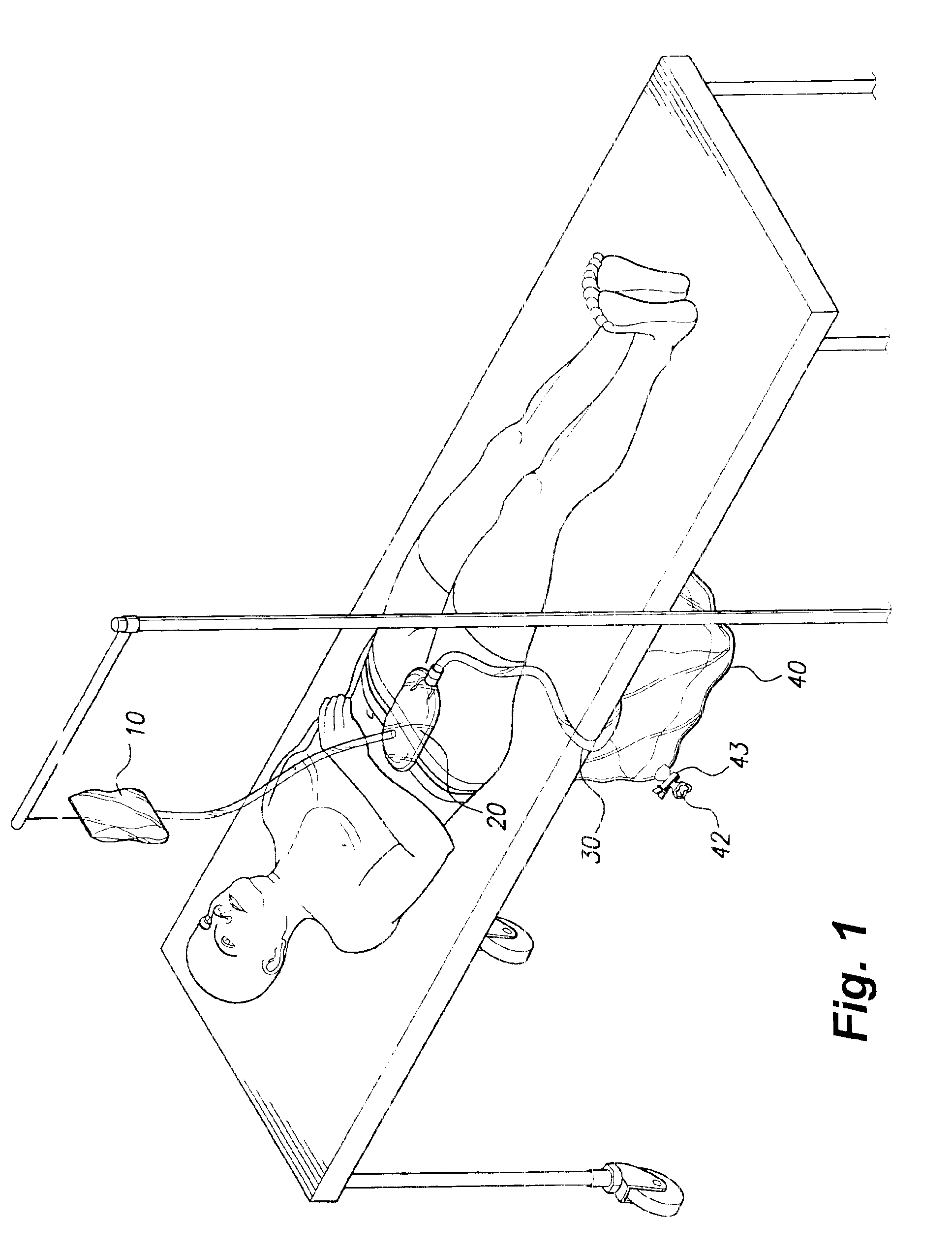 Closed drainage system for irrigating ostomies