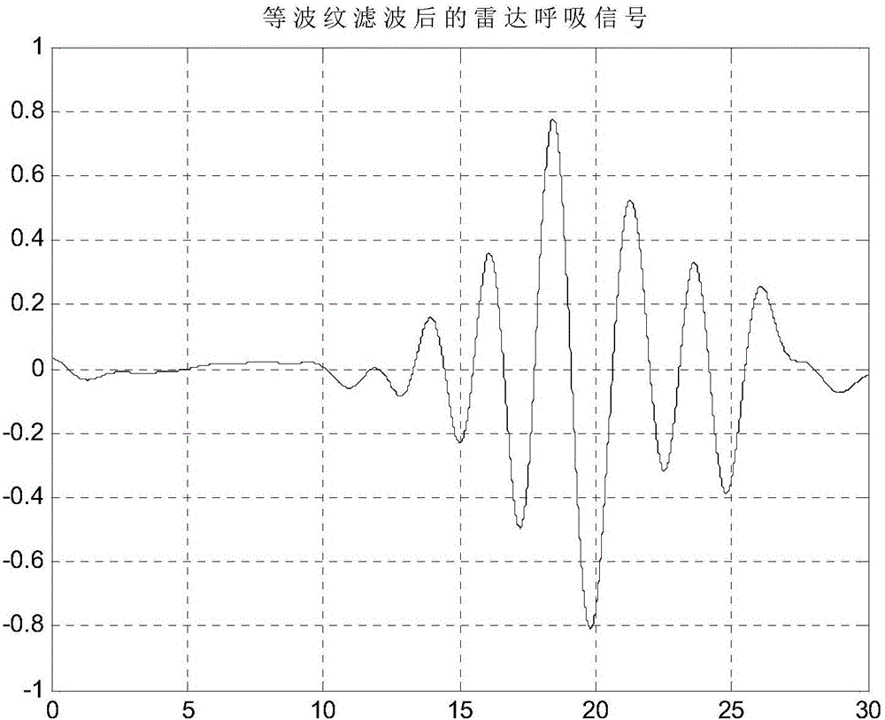 Respiratory pattern judgement method based on respiratory pattern monitoring radar