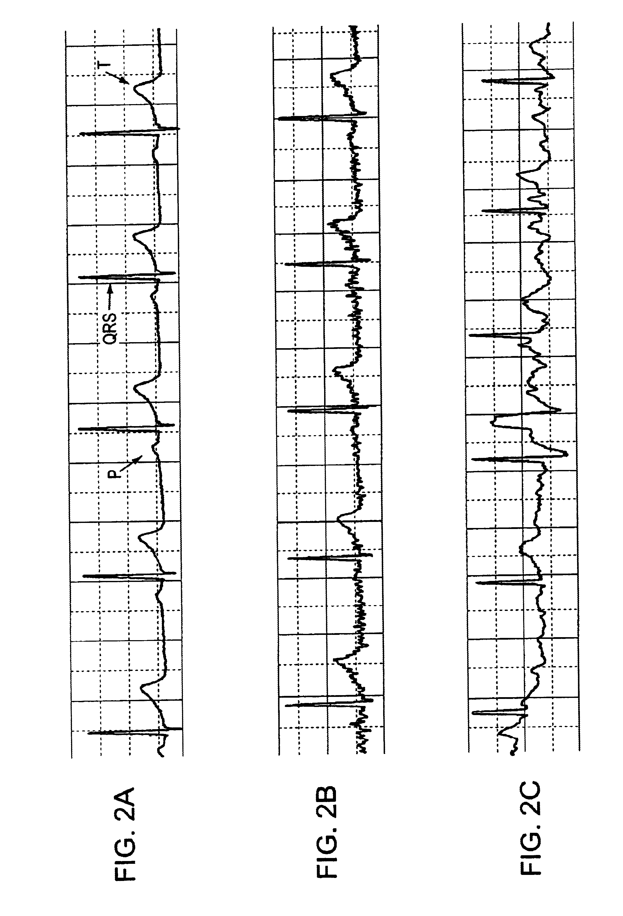 Electrode systems and methods for reducing motion artifact