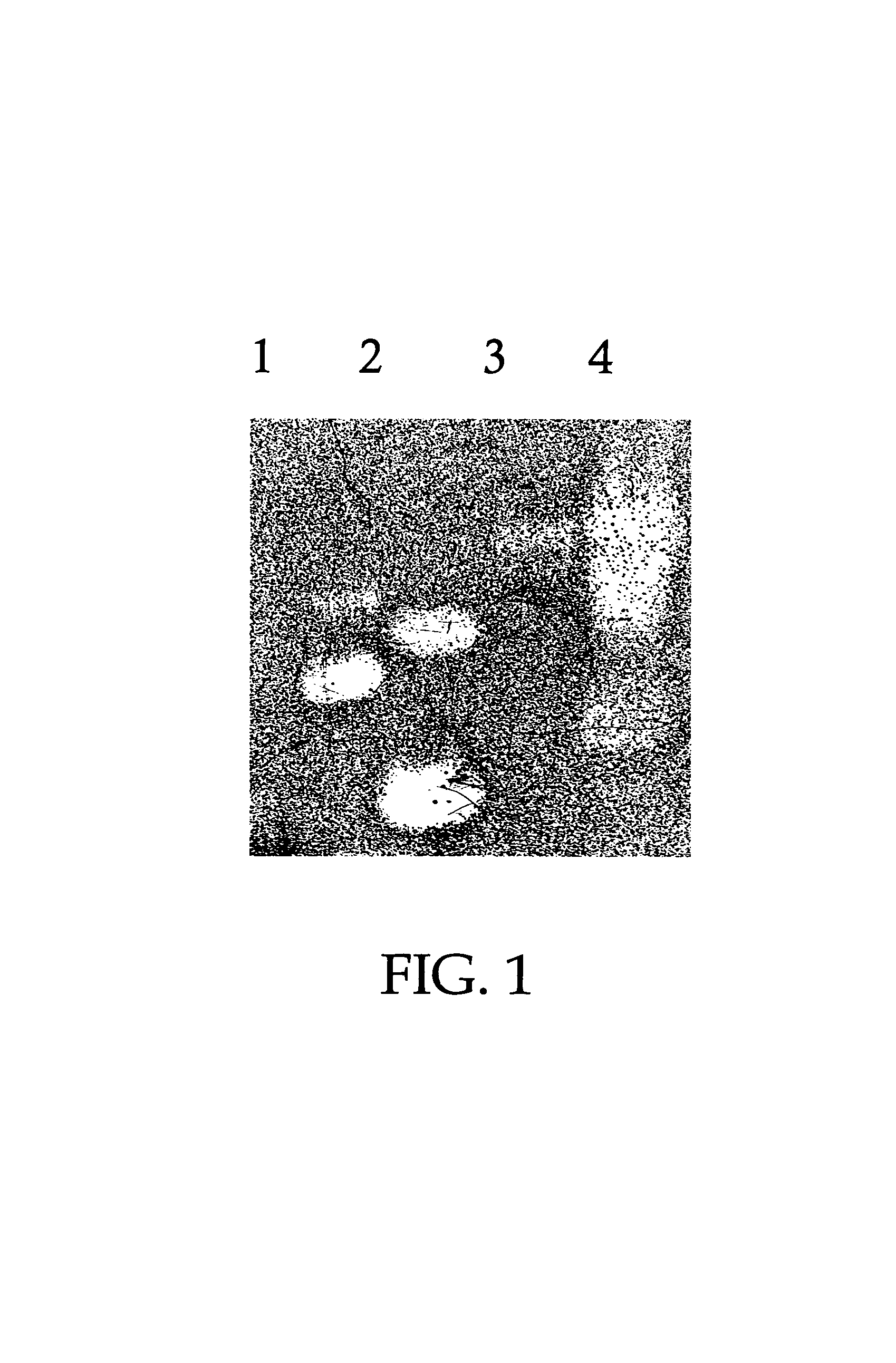 Use of antimicrobial proteins and peptides for the treatment of otitis media and paranasal sinusitis