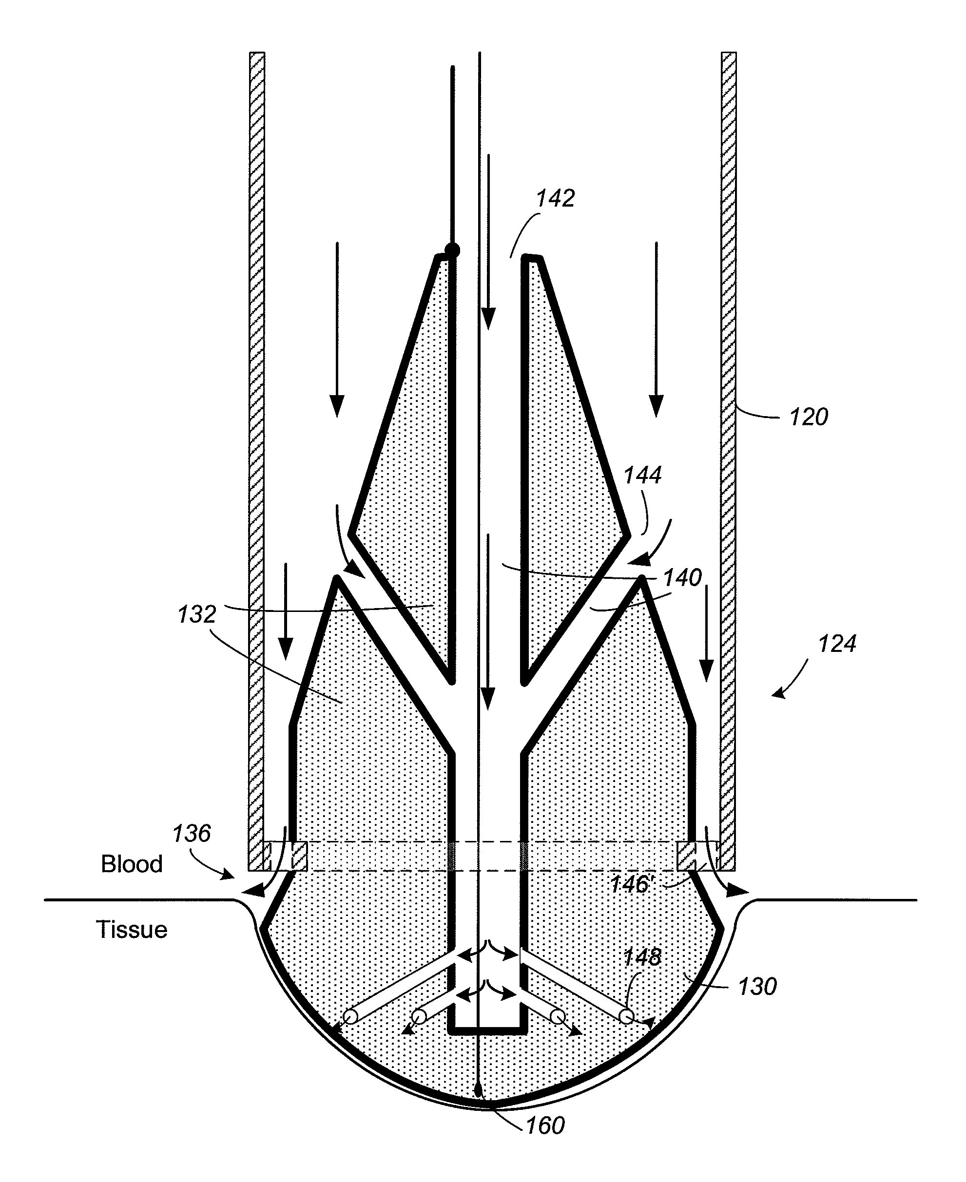 Catheter and method for improved ablation