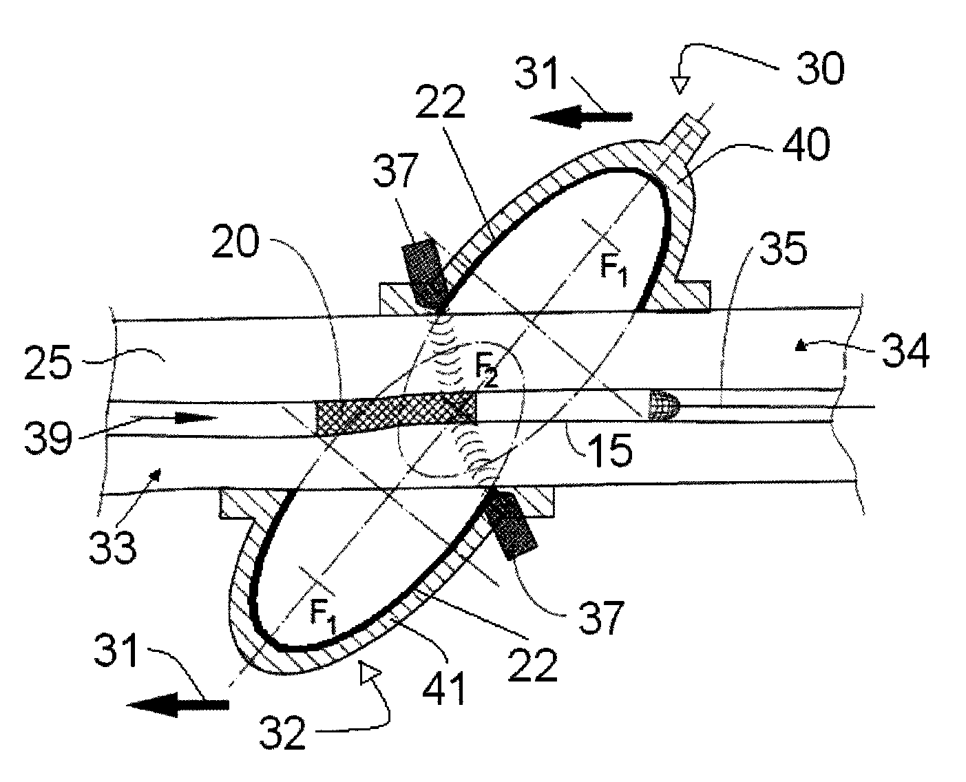 Extracorporeal pressure shock wave device