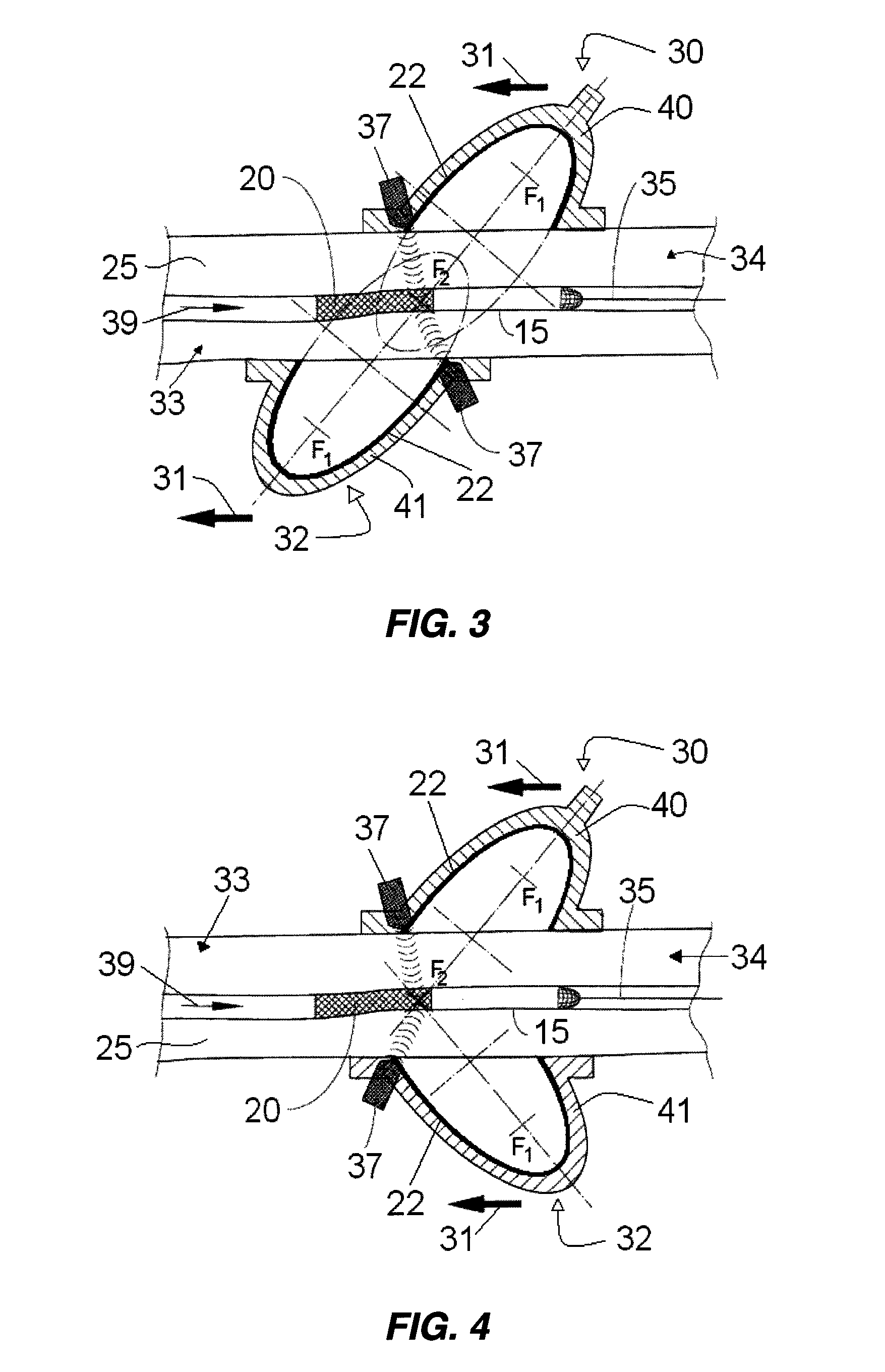 Extracorporeal pressure shock wave device