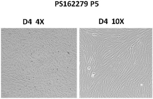 Placenta mesenchymal stem cell preparation and application of placental mesenchymal stem cell preparation in treating sclerosis