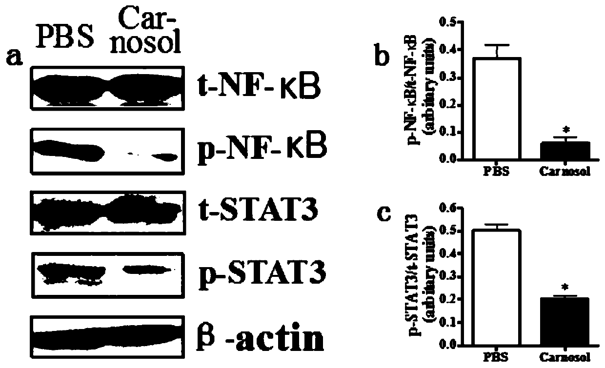 Application of carnosol in the preparation of drugs for preventing and treating experimental autoimmune encephalomyelitis