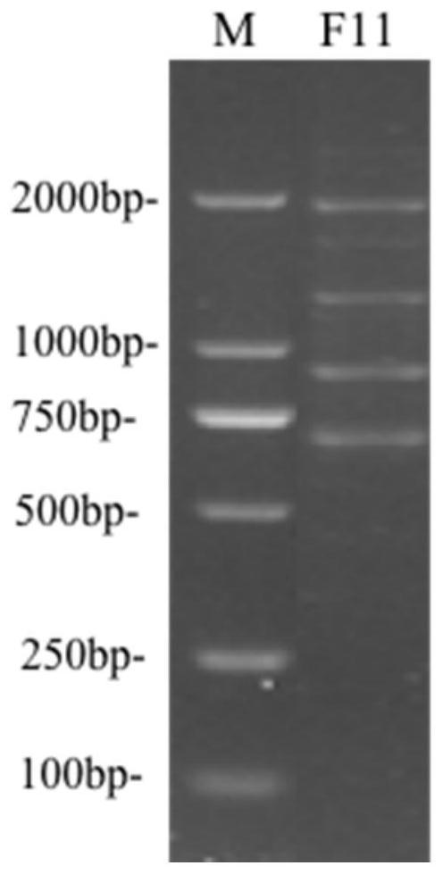 Lactobacillus paracasei and application thereof in prevention of streptococcus infection of infants