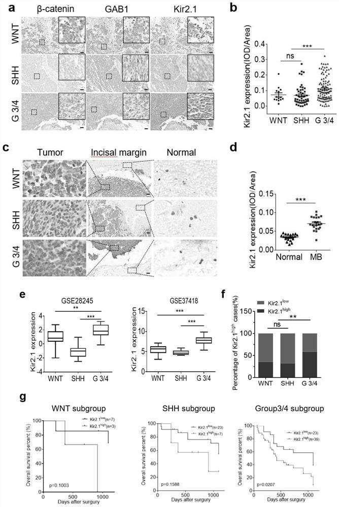 Application of Kir2.1 as target spot to preparation of reagent or medicine for treating, preventing or diagnosing medulloblastoma