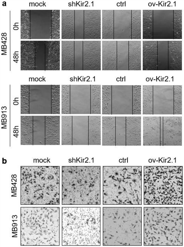 Application of Kir2.1 as target spot to preparation of reagent or medicine for treating, preventing or diagnosing medulloblastoma