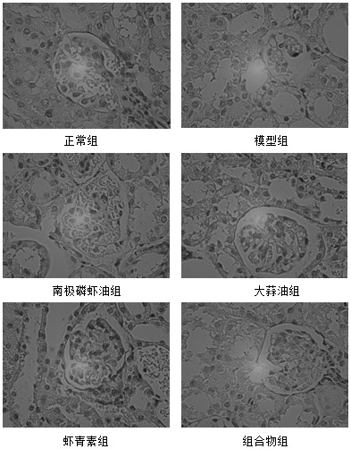 Composition capable of reducing hyperuricemia level in serum and application thereof