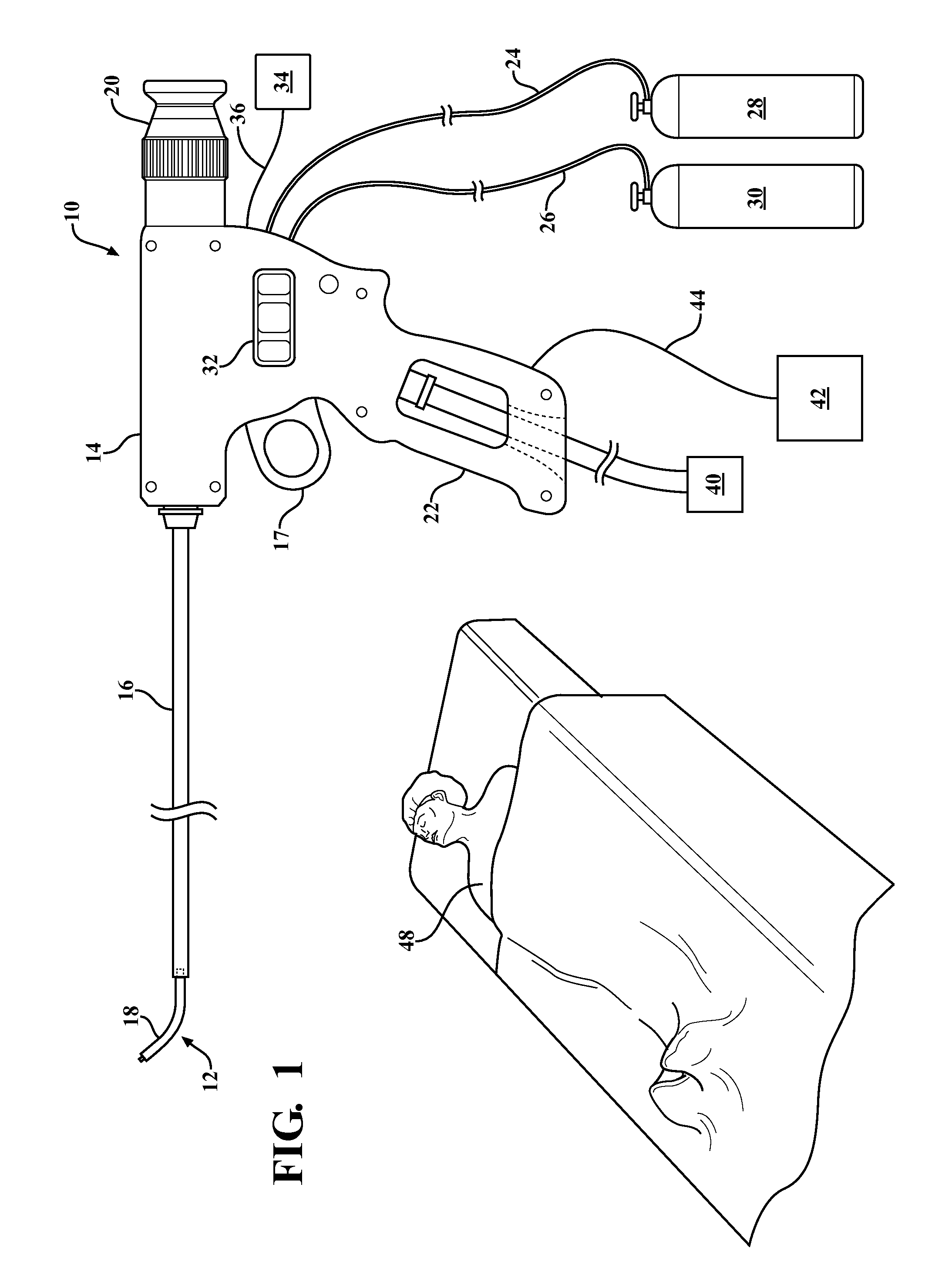 Method and apparatus for cold plasma treatment of internal organs