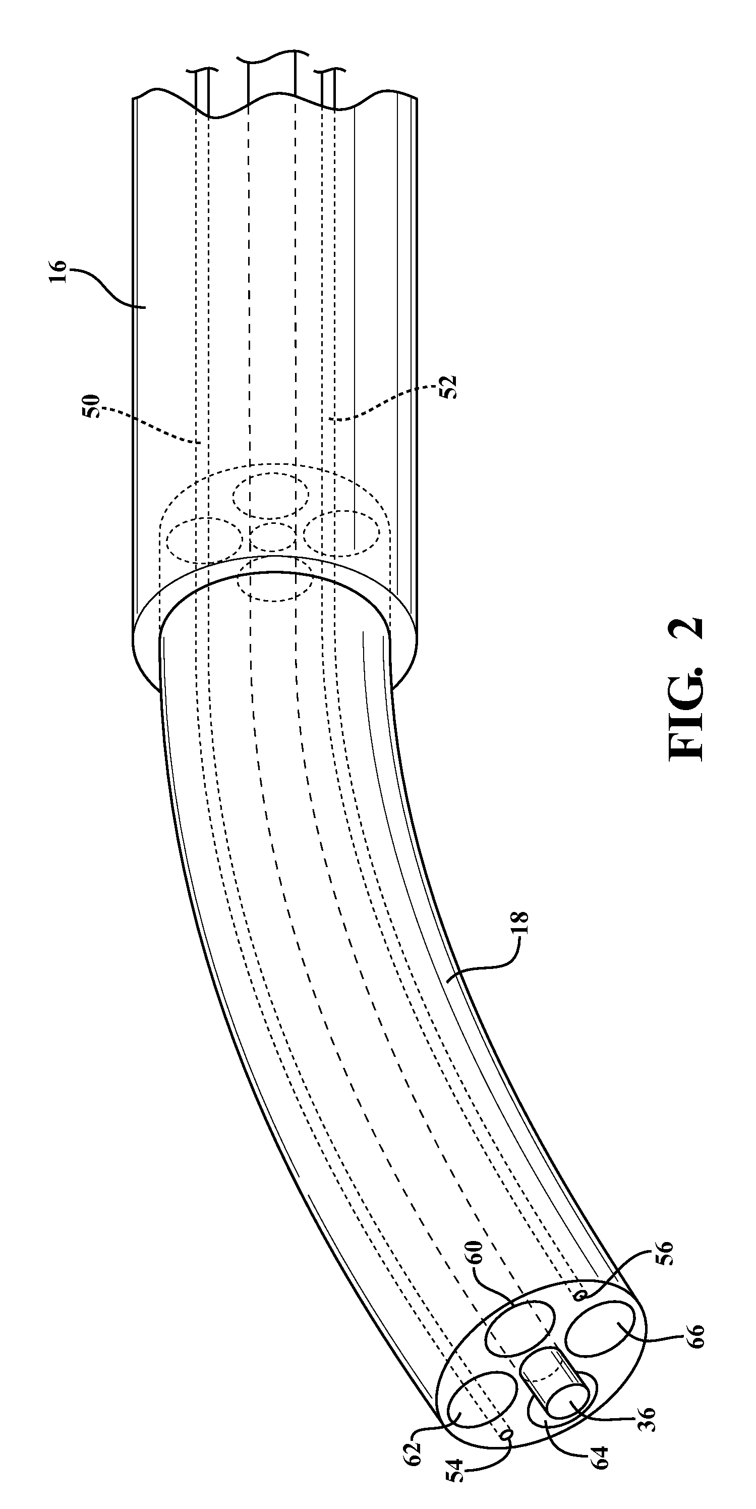Method and apparatus for cold plasma treatment of internal organs