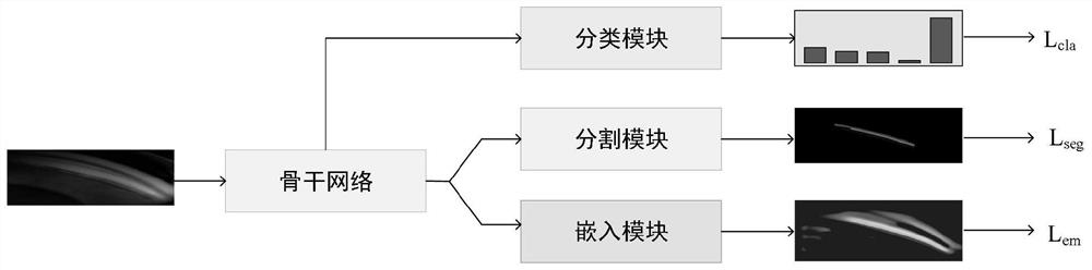 Anterior chamber angle image grading method fused with weak supervision metric learning